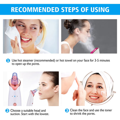 Electric Blackhead Vacuum - Professional Pore Cleaner & Acne Remover