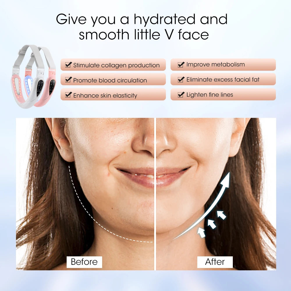 V-Face EMS Microcurrent Lifting Device - Red Light Skin Rejuvenator