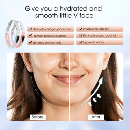 V-Face EMS Microcurrent Lifting Device - Red Light Skin Rejuvenator