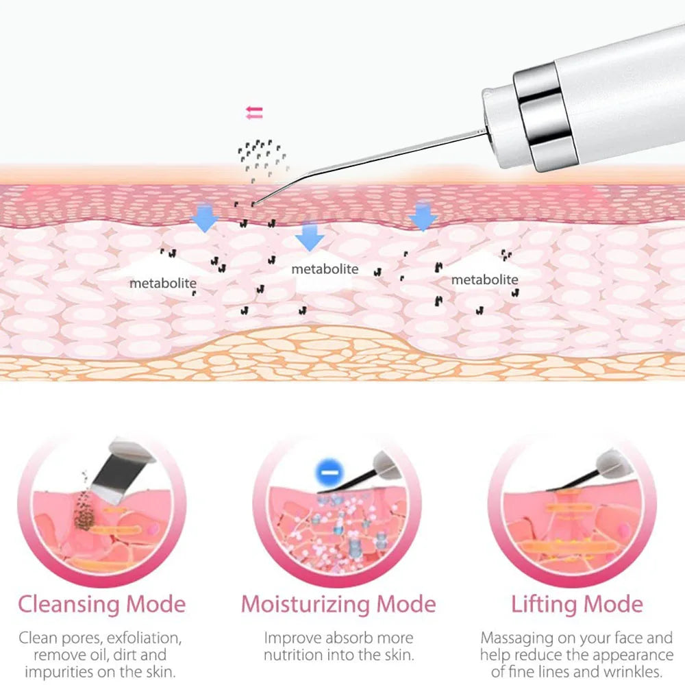 Ultrasonic Skin Scrubber - Professional Deep Pore Cleansing Shovel